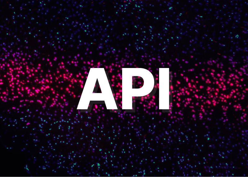 API Test Automation in QA Software Testing Services